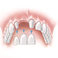 имплантация зубов в Куркино